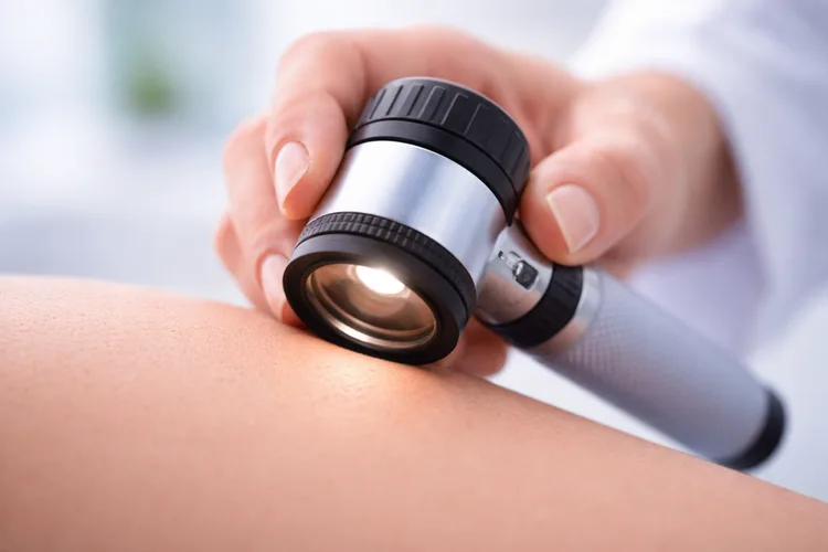 AI Advancements in Dermatology: Early Detection, Precision Treatment & Smarter Clinical Care